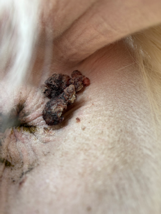 Perianal mass in a pinto quarter horse gelding